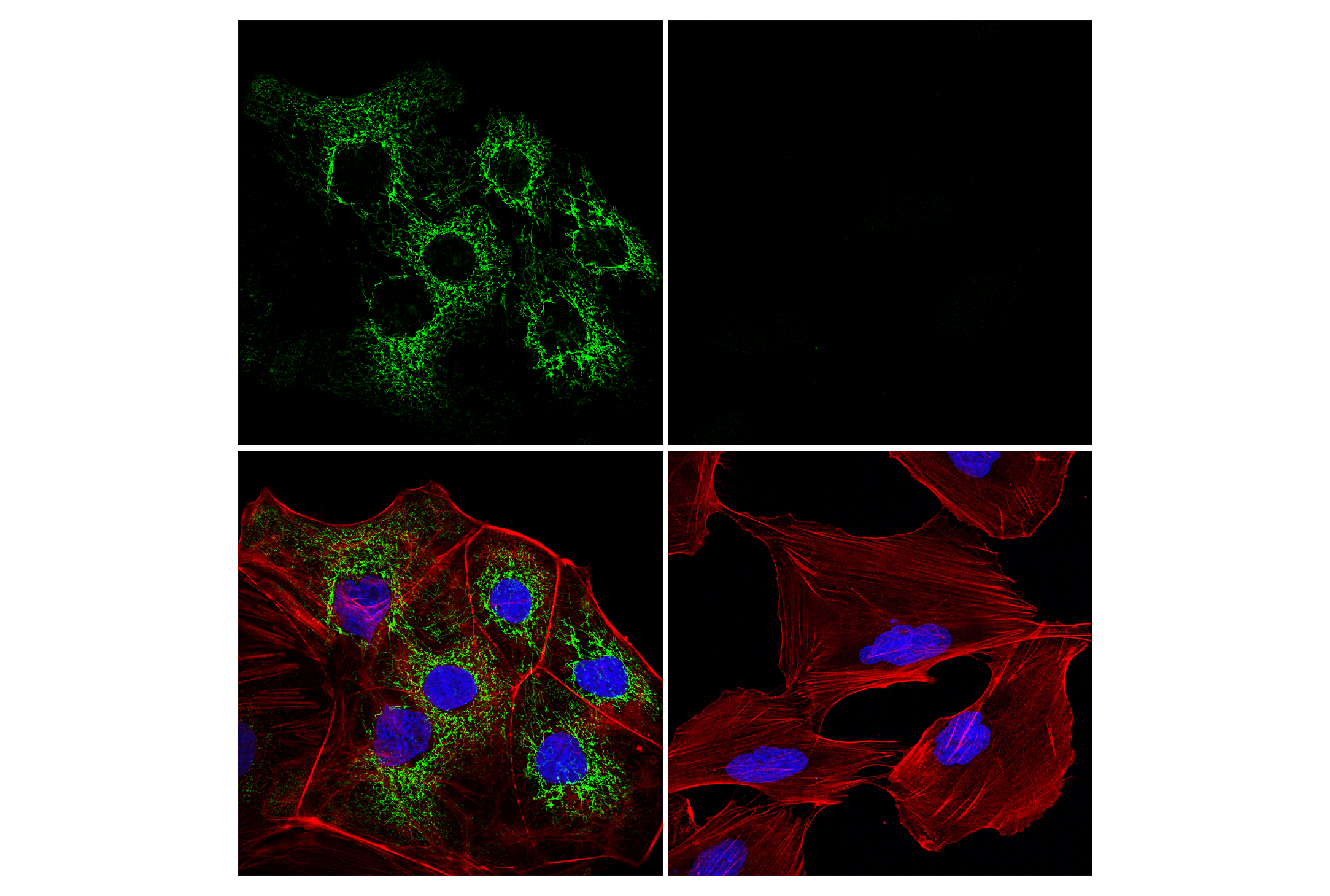Immunofluorescence Image 1: MTHFD2 (E7A4L) XP® Rabbit mAb (Alexa Fluor® 488 Conjugate)
