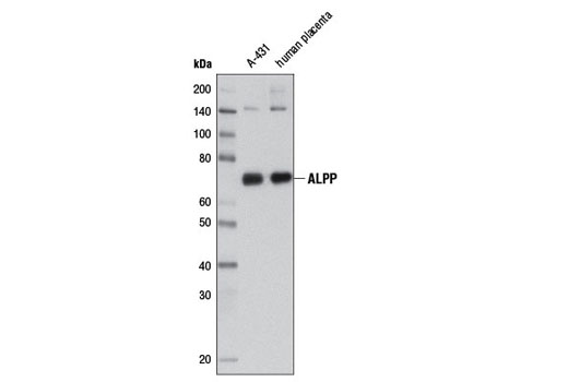 Western Blotting Image 1: ALPP (3E5C7) Mouse mAb