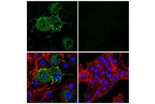 Immunofluorescence Image 3: CD36 (E8B7S) Rabbit mAb (BSA and Azide Free)