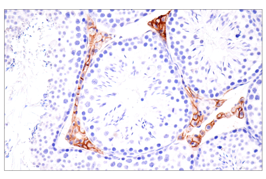 Immunohistochemistry Image 4: CD36 (E8B7S) Rabbit mAb (BSA and Azide Free)