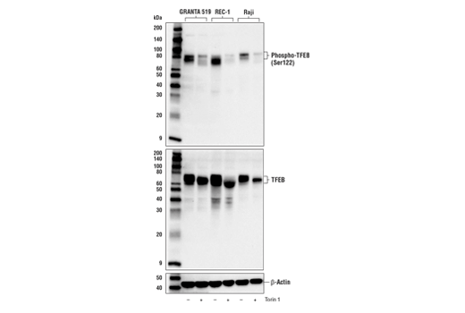  Image 10: TFEB Signaling Antibody Sampler Kit