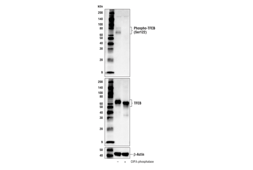 Western Blotting Image 2: Phospho-TFEB (Ser122) Antibody