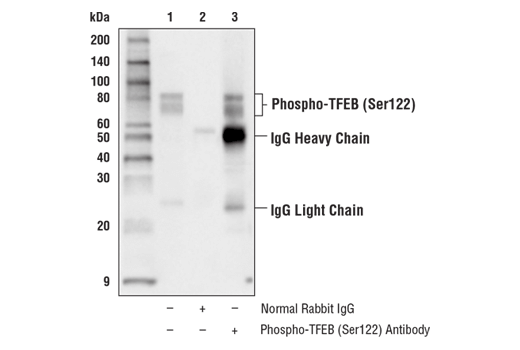 Immunoprecipitation Image 1: Phospho-TFEB (Ser122) Antibody