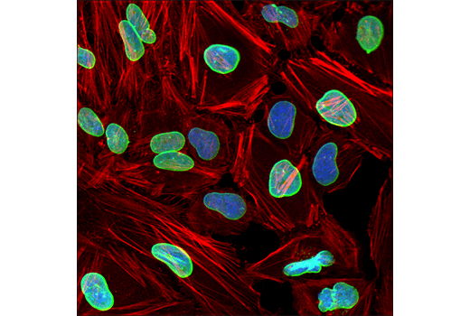 Immunofluorescence Image 1: Lamin A (133A2) Mouse mAb