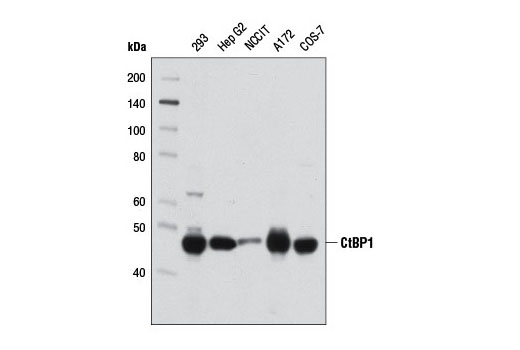  Image 12: Huntingtin Interaction Antibody Sampler Kit