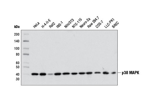  Image 2: PhosphoPlus® p38 MAPK (Thr180/Tyr182) Antibody Duet