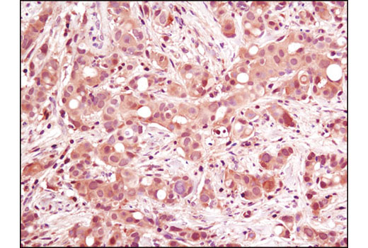  Image 4: PhosphoPlus® p38 MAPK (Thr180/Tyr182) Antibody Duet