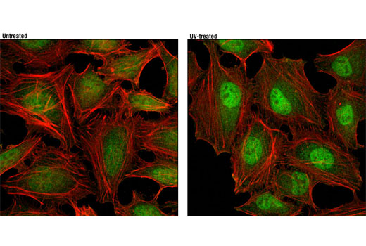 Immunofluorescence Image 1: p38 MAPK (D13E1) XP® Rabbit mAb