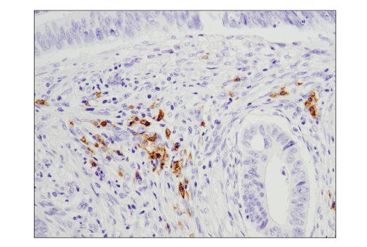 Immunohistochemistry Image 5: CD19 (Intracellular Domain) (D4V4B) XP® Rabbit mAb (BSA and Azide Free)