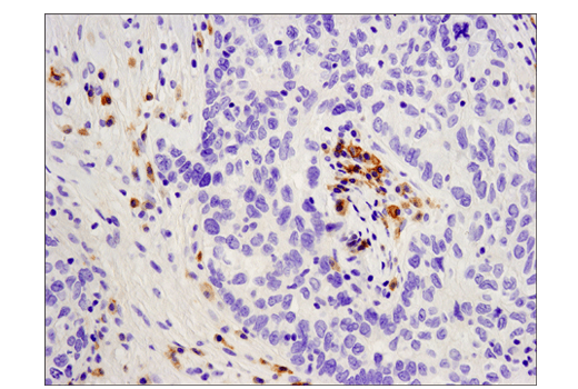 Immunohistochemistry Image 1: CD19 (Intracellular Domain) (D4V4B) XP® Rabbit mAb (BSA and Azide Free)