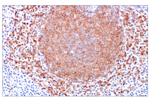 Immunohistochemistry Image 7: CD19 (Intracellular Domain) (D4V4B) XP® Rabbit mAb (BSA and Azide Free)