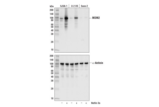  Image 10: PROTAC E3 Ligase Profiling Antibody Sampler Kit