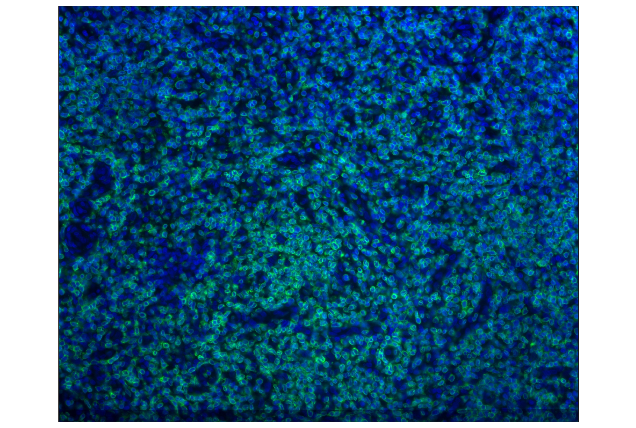 Immunohistochemistry Image 1: CD3ε (D7A6E™) XP® Rabbit mAb (Alexa Fluor® 488 Conjugate)