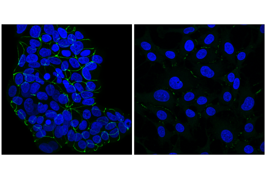 Immunofluorescence Image 1: ZO-1 (D6L1E) Rabbit mAb (Alexa Fluor® 488 Conjugate)