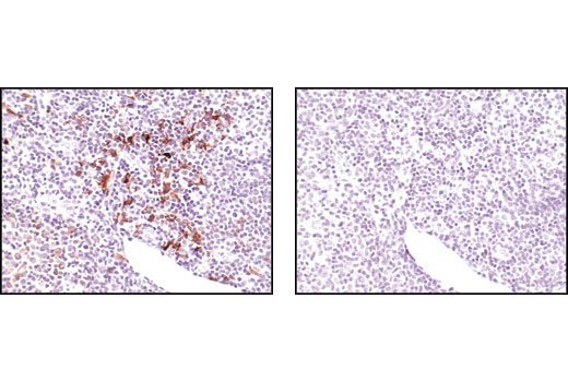 Immunohistochemistry Image 1: TRAF1 (45D3) Rabbit mAb (BSA and Azide Free)