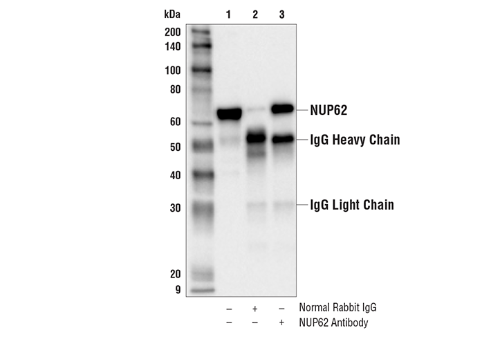 Immunoprecipitation Image 1: NUP62 Antibody
