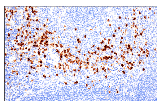 Immunohistochemistry Image 1: Ly-6G (E6Z1T) Rabbit mAb