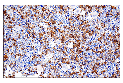 Immunohistochemistry Image 4: Ly-6G (E6Z1T) Rabbit mAb