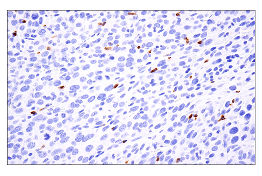 Immunohistochemistry Image 6: Ly-6G (E6Z1T) Rabbit mAb