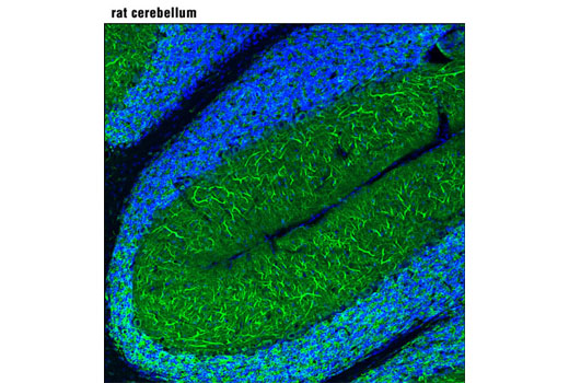 Immunofluorescence Image 1: MAP2 (D5G1) XP® Rabbit mAb