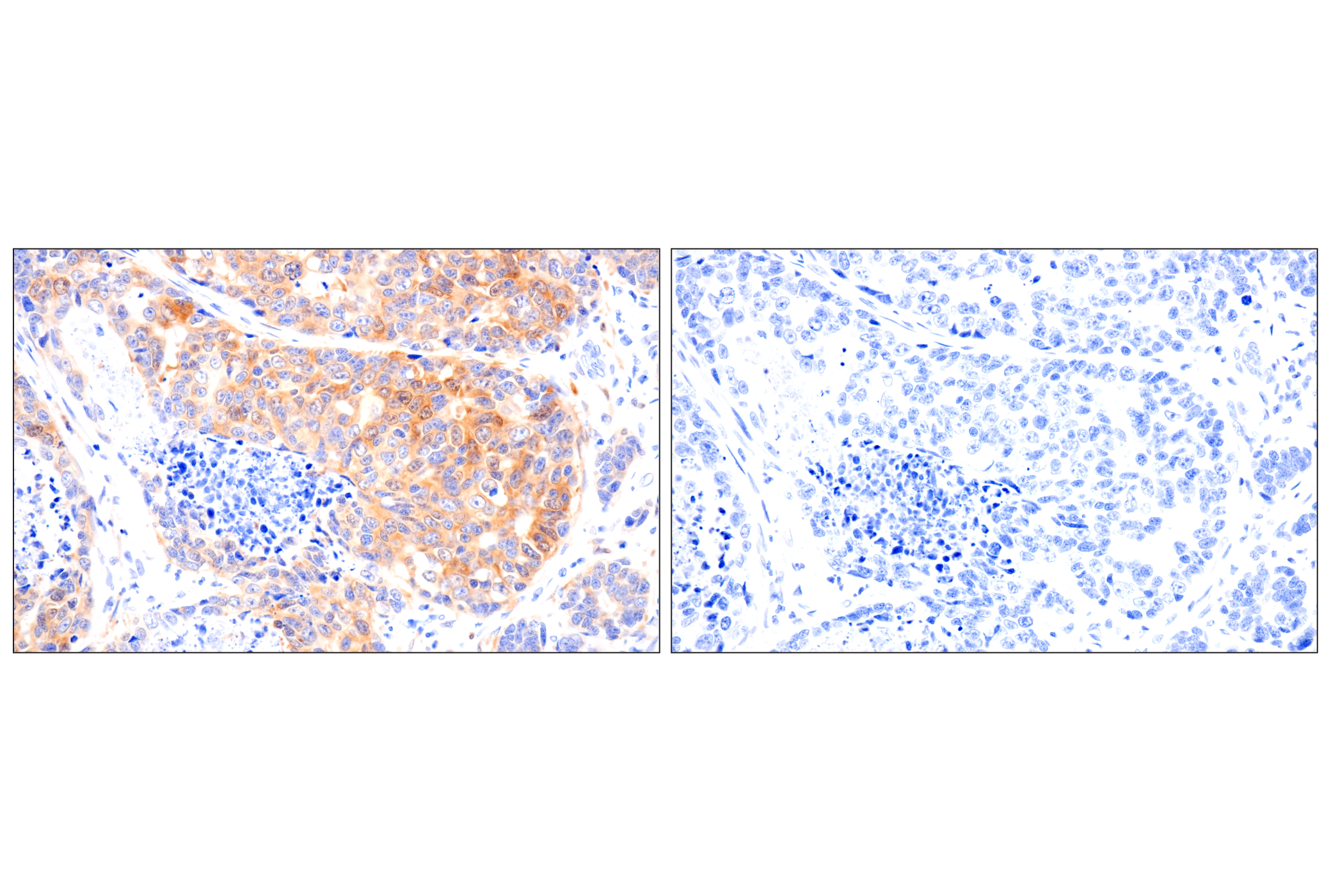 Immunohistochemistry Image 11: FAK (F7Z4C) Mouse mAb (BSA and Azide Free)