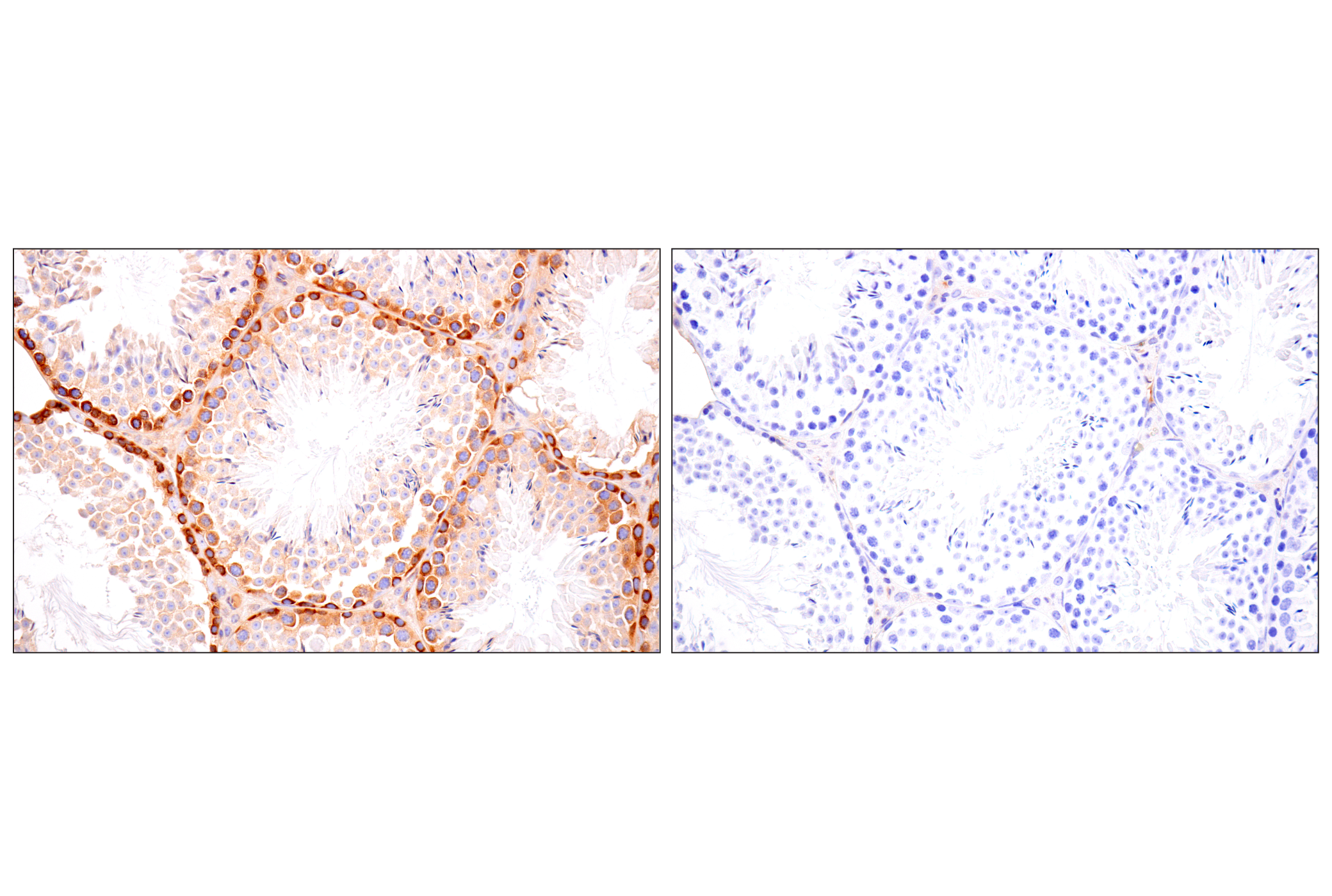 Immunohistochemistry Image 8: FAK (F7Z4C) Mouse mAb (BSA and Azide Free)
