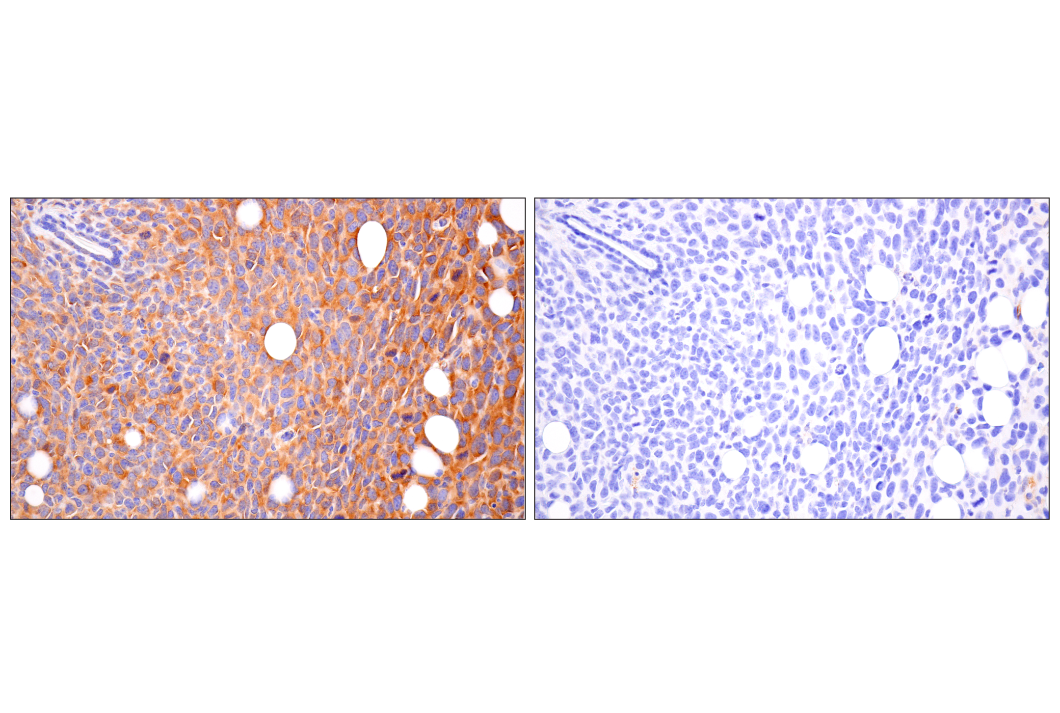 Immunohistochemistry Image 7: FAK (F7Z4C) Mouse mAb (BSA and Azide Free)