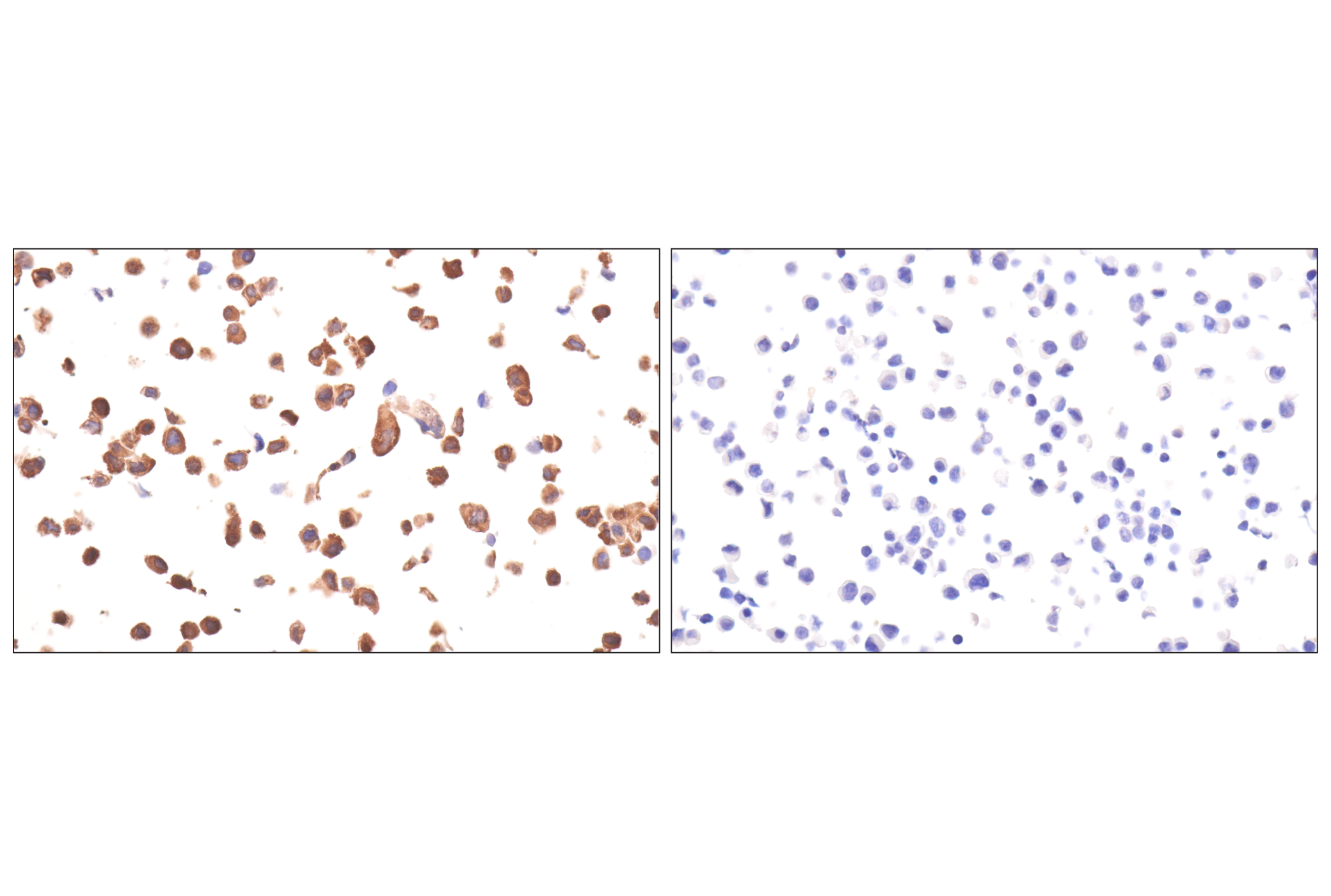Immunohistochemistry Image 12: FAK (F7Z4C) Mouse mAb (BSA and Azide Free)