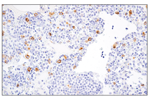 Immunohistochemistry Image 4: RHAMM/CD168 (E7S4Y) Rabbit mAb
