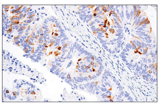 Immunohistochemistry Image 1: RHAMM/CD168 (E7S4Y) Rabbit mAb