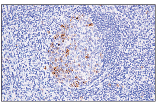 Immunohistochemistry Image 6: RHAMM/CD168 (E7S4Y) Rabbit mAb