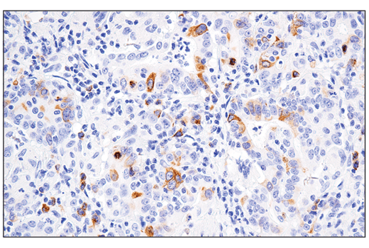 Immunohistochemistry Image 3: RHAMM/CD168 (E7S4Y) Rabbit mAb