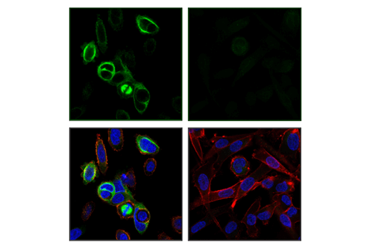 Immunofluorescence Image 1: RHAMM/CD168 (E7S4Y) Rabbit mAb