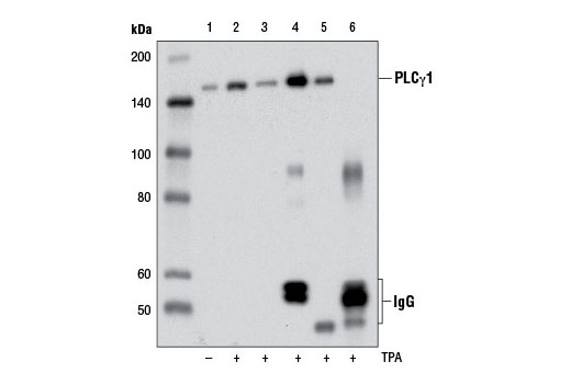 Immunoprecipitation Image 1: Phospho-PLCγ1 (Ser1248) (D25A9) Rabbit mAb