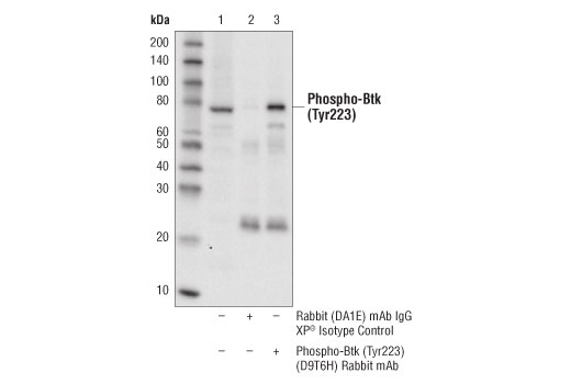 Immunoprecipitation Image 1: Phospho-Btk (Tyr223) (D9T6H) Rabbit mAb