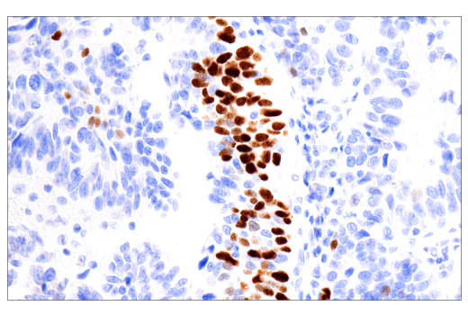Immunohistochemistry Image 2: p40 (BC28) Mouse mAb