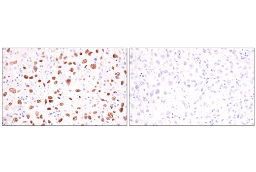 Immunohistochemistry Image 7: p40 (BC28) Mouse mAb