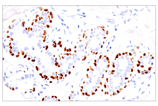 Immunohistochemistry Image 6: p40 (BC28) Mouse mAb