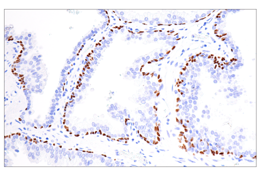 Immunohistochemistry Image 5: p40 (BC28) Mouse mAb