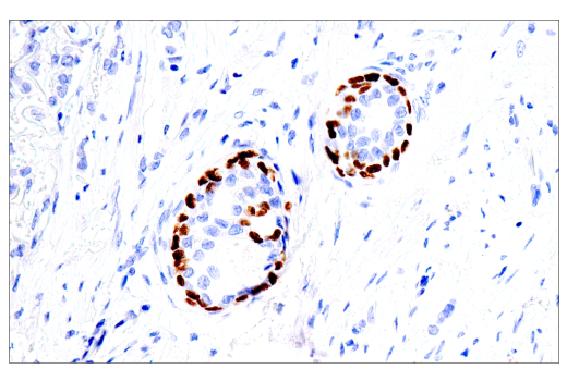 Immunohistochemistry Image 1: p40 (BC28) Mouse mAb