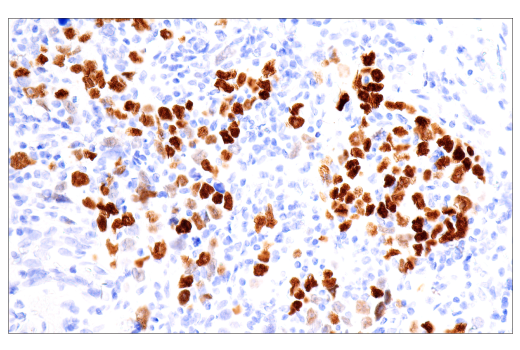 Immunohistochemistry Image 3: p40 (BC28) Mouse mAb