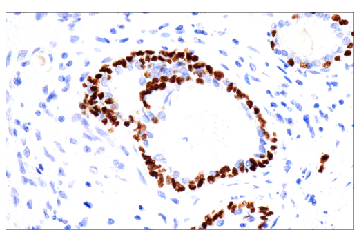Immunohistochemistry Image 4: p40 (BC28) Mouse mAb