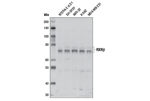 Western Blotting Image 1: RXRβ Antibody