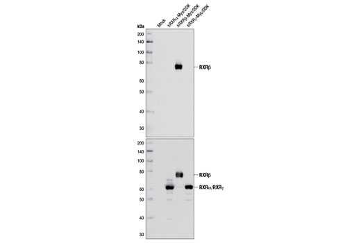  Image 10: Retinoic Acid and Retinoid X Receptors Antibody Sampler Kit