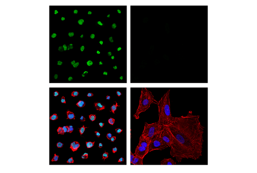 Immunofluorescence Image 1: LMO2 (E8K6I) Rabbit mAb