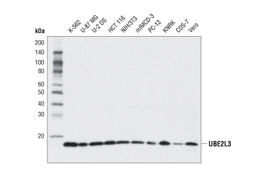  Image 7: Ubiquitin Activation (E1, E2 Enzymes) Antibody Sampler Kit