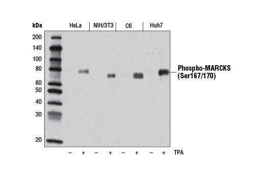Western Blotting Image 2: Phospho-MARCKS (Ser167/170) (D13E4) XP® Rabbit mAb