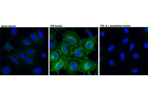 Immunofluorescence Image 1: Phospho-MARCKS (Ser167/170) (D13E4) XP® Rabbit mAb