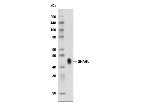  Image 14: Extracellular Matrix Dynamics Antibody Sampler Kit