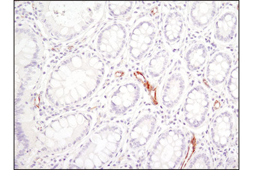 Immunohistochemistry Image 1: SPARC (D10F10) Rabbit mAb
